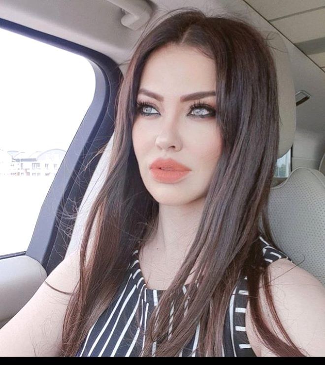 Lara'yı gören tanıyamıyor! 7