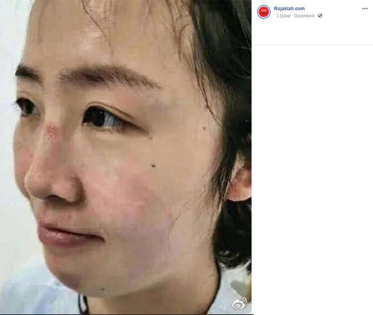 Korona izleri yüzlerinde 10
