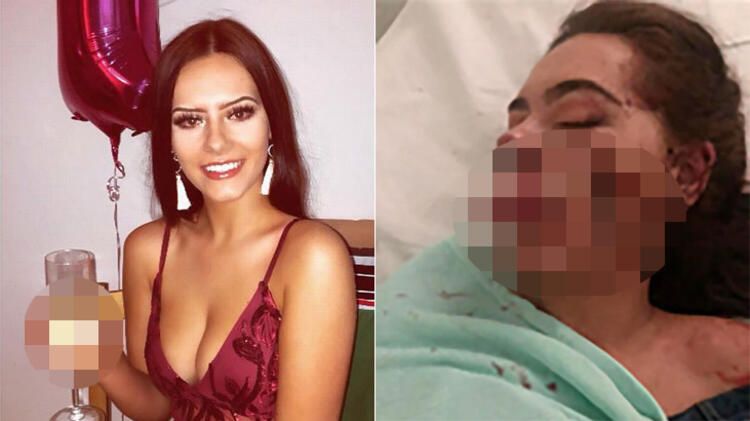 İki kadın iki dehşet! Tanınmaz hale geldiler... 1