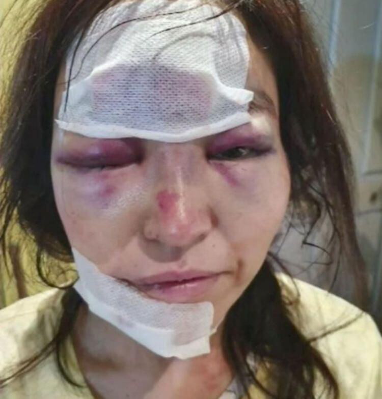 İki kadın iki dehşet! Tanınmaz hale geldiler... 10