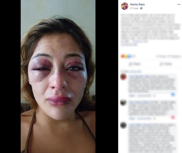 Güzel model dehşeti yaşadı! Her detayı korkunç... 9
