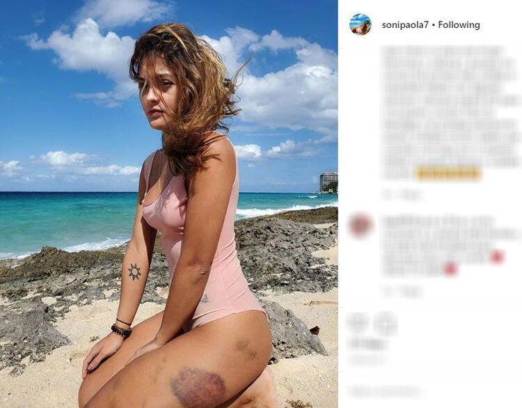 Güzel model dehşeti yaşadı! Her detayı korkunç... 16