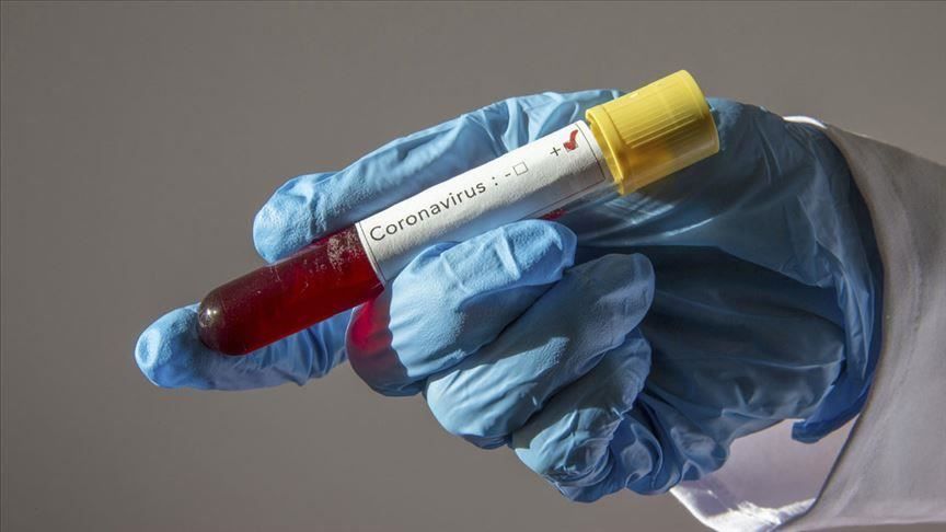 20 Türk doktor üzerinde çalıştı! Korona hastalarının 'deliryum' oranı yüksek 18