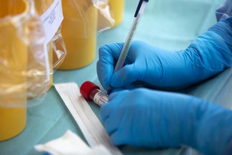 Dünya bu kelimeleri konuşuyor: Sessiz hipoksi! ABD'li doktor anlattı... 29