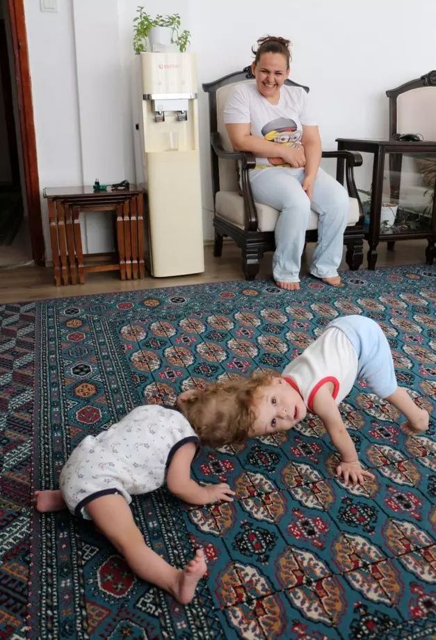 Siyam ikizlerinden ilk görüntü! 9