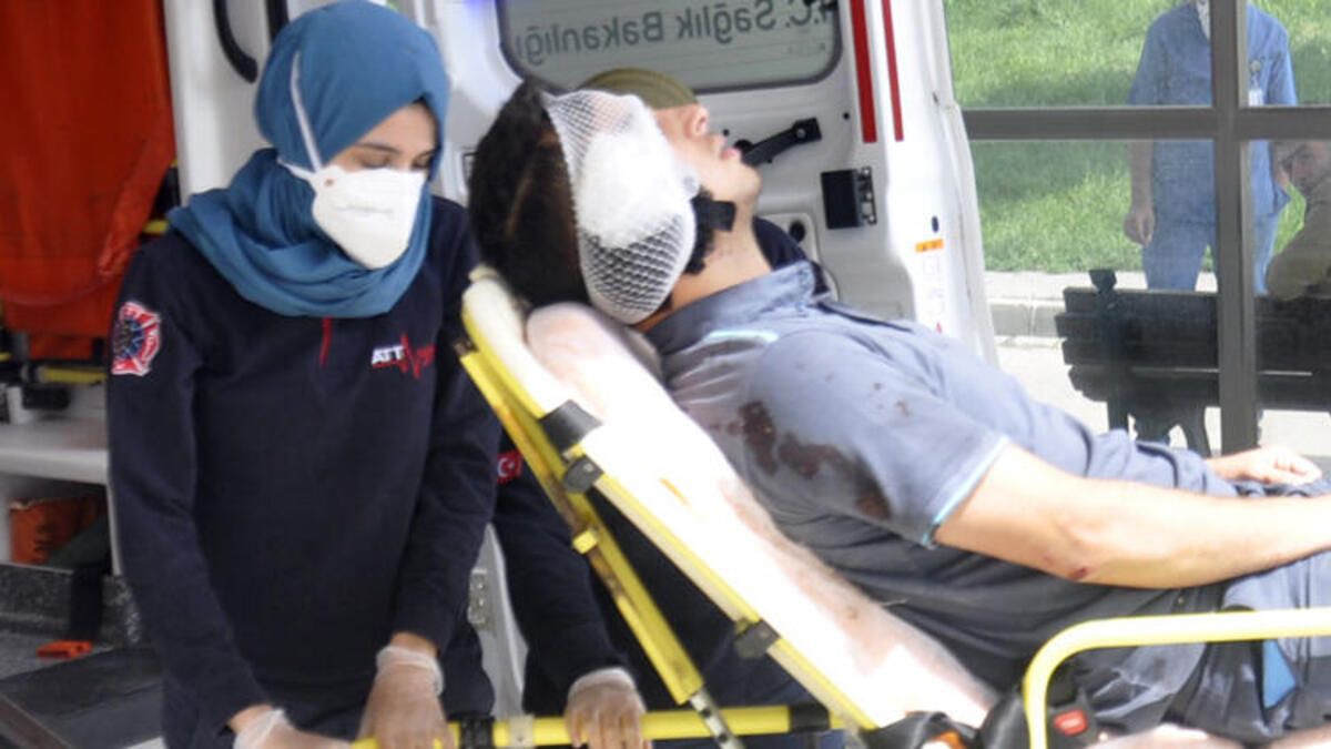 Tartıştığı postacının kulağını kopardı 4