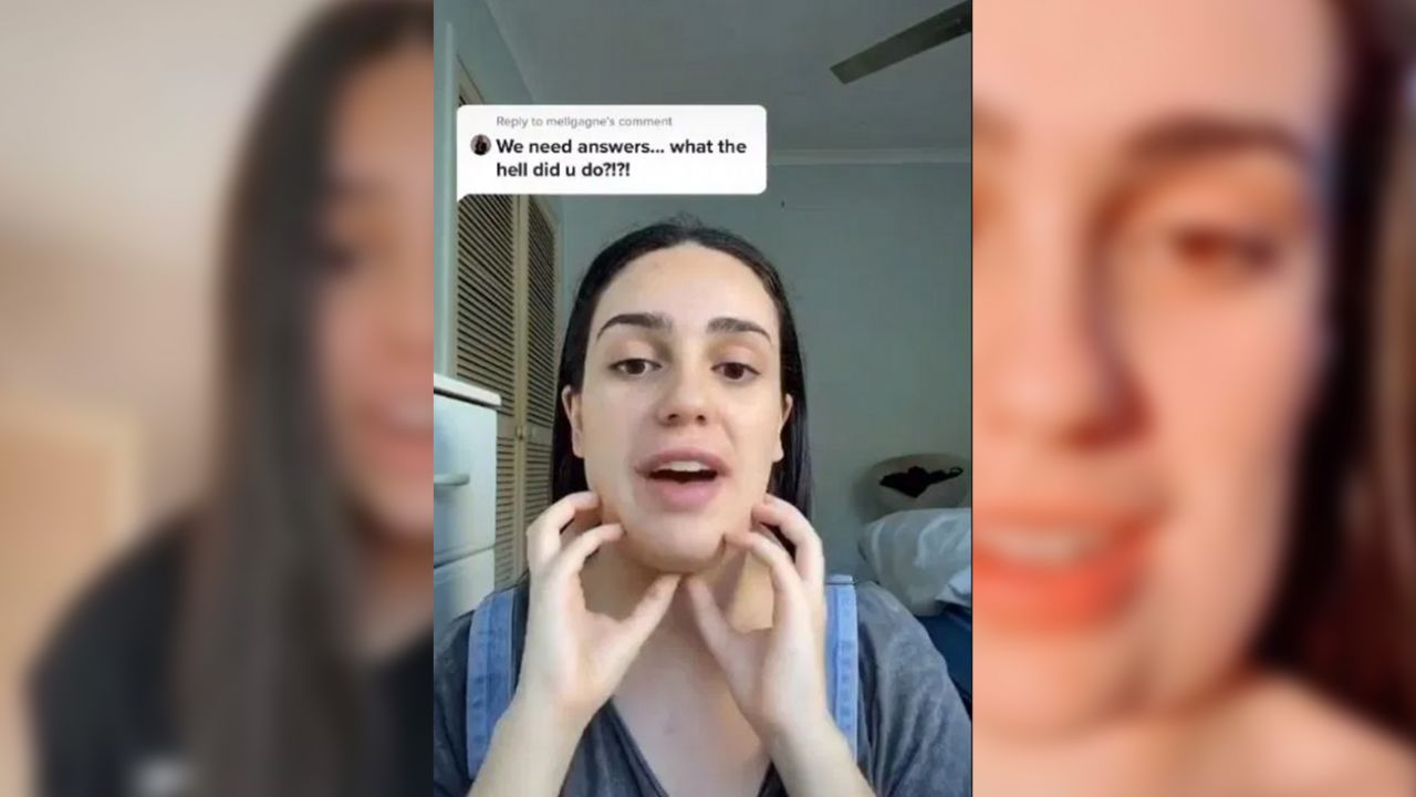 Estetik yaptırdı, yüzü kare oldu! 12