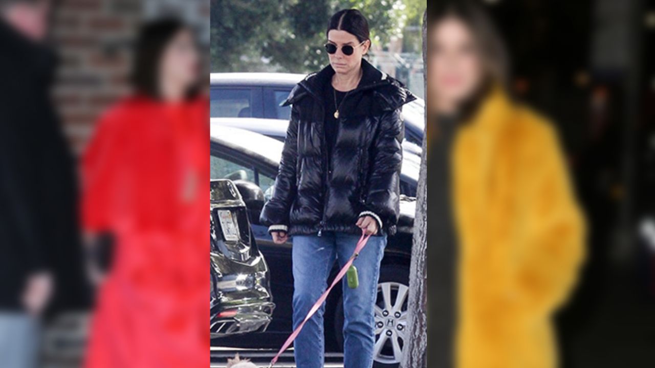Sandra Bullock itiraf etti! Yüzüne çocuk derisi enjekte ettiriyor! 6