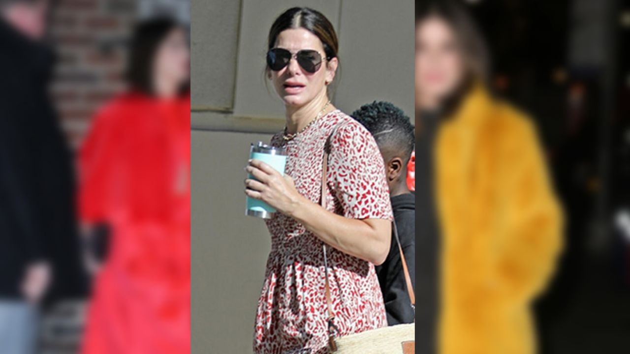 Sandra Bullock itiraf etti! Yüzüne çocuk derisi enjekte ettiriyor! 7