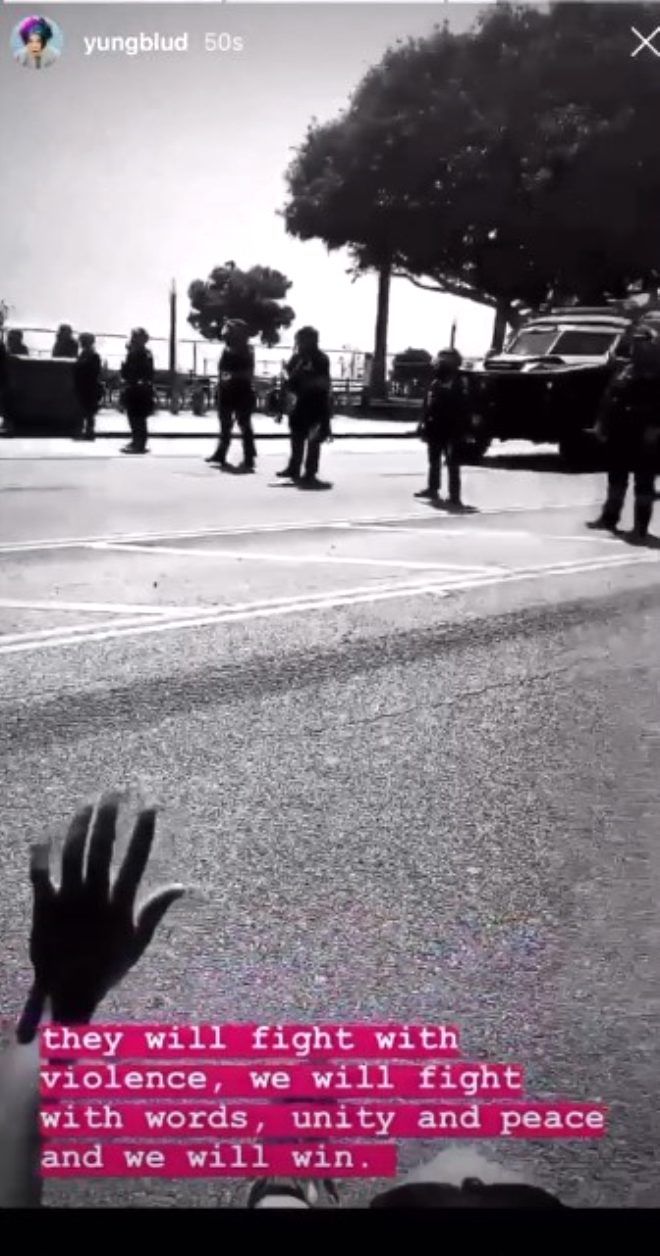 Protestolara katılan ünlü şarkıcı vuruldu 2