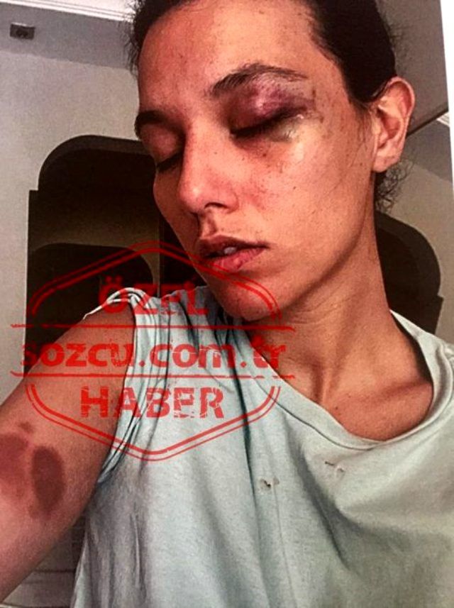 Ozan Güven'in Deniz Bulutsuz'u darbına dair yeni görüntüler ortaya çıktı 3
