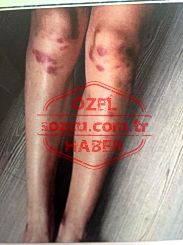 Ozan Güven'in Deniz Bulutsuz'u darbına dair yeni görüntüler ortaya çıktı 5