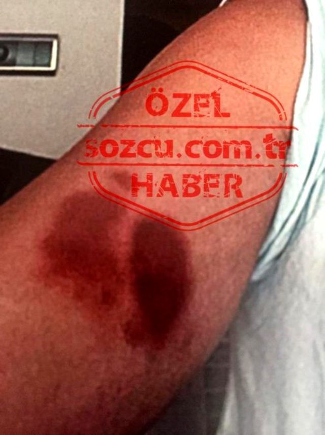 Ozan Güven'in Deniz Bulutsuz'u darbına dair yeni görüntüler ortaya çıktı 8