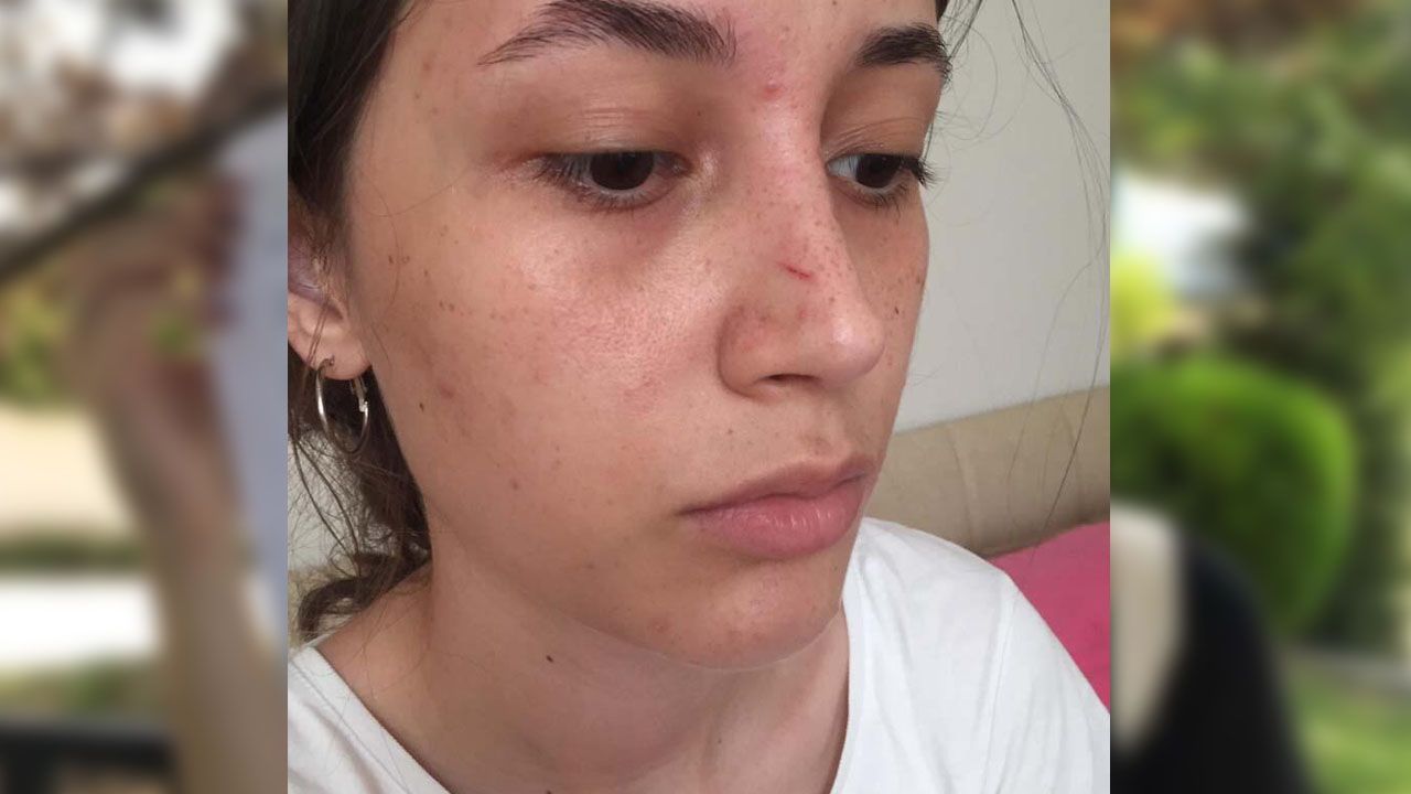 Şort giydiği için darp edilen kadın konuştu! 3