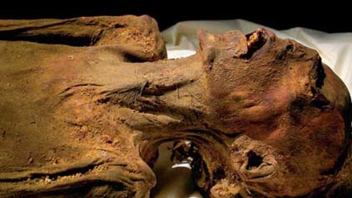İşte 'çığlık atan mumya'nın ölüm sebebi 4