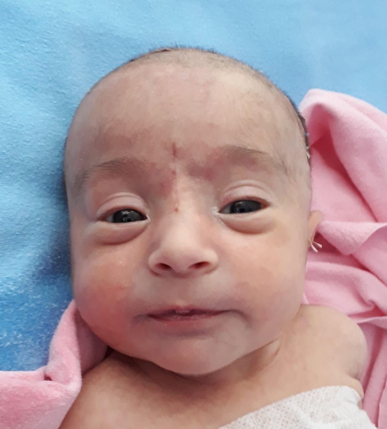 Minik Buğlem'in yaşam savaşı 2