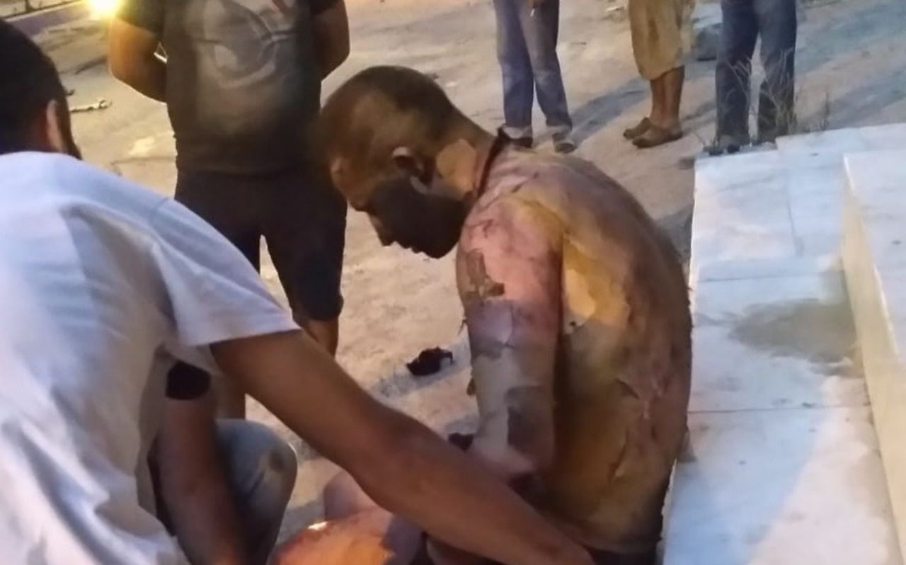 Tartıştıkları adamı ateşe verdiler! 1