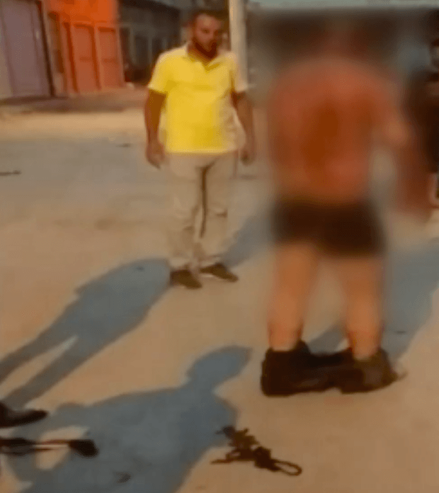 Tartıştıkları adamı ateşe verdiler! 3