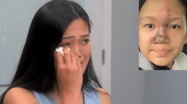 Melisa'nın burnu günden güne eridi 4