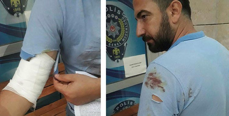 9 aylık hamile kadını darp etti! Eşini ise bıçakladı... 4