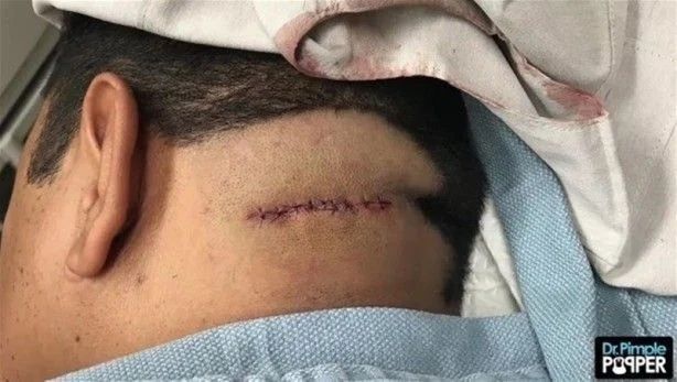 17 yıl boyunca kafasında solucanla yaşadı! 18