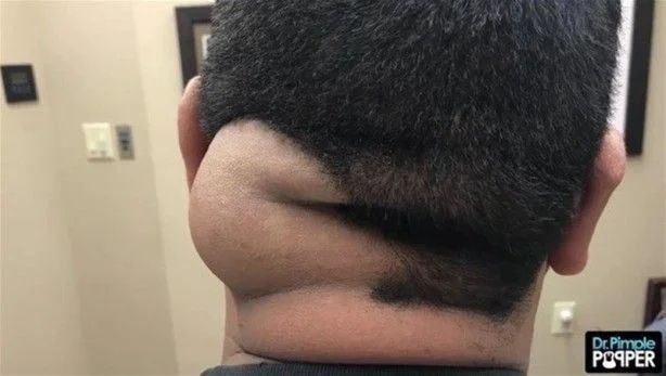 17 yıl boyunca kafasında solucanla yaşadı! 8
