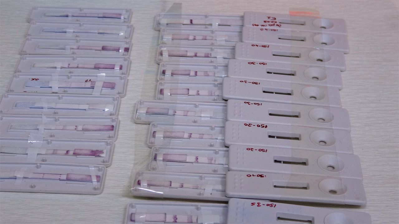 Çift antikorlu koronavirüs tanı kiti ÇOMÜ’de geliştirildi! 1