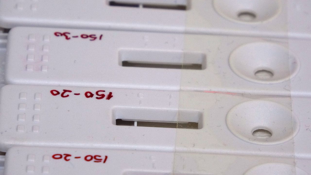 Çift antikorlu koronavirüs tanı kiti ÇOMÜ’de geliştirildi! 2
