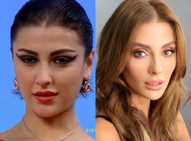 Özge Ulusoy'un yıllar içindeki değişimi şaşırttı! 5