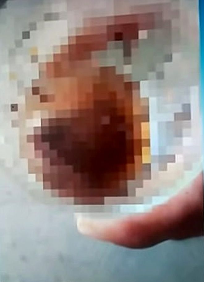 Kendisine tecavüz etmeye kalkan eski sevgilisinin cinsel organını ısırıp kopardı! 4