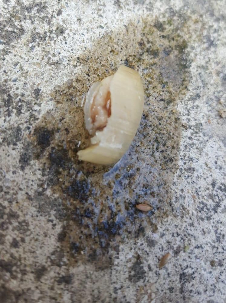 Kopan parmak işçinin yemeğinden çıktı! 3