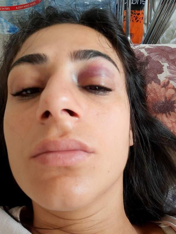 Sokak ortasında taciz edildi... Karşı koyunca tekme tokat dövüldü! 6