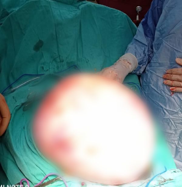 Karnından çıktı! Tam 5.5 kilo 2