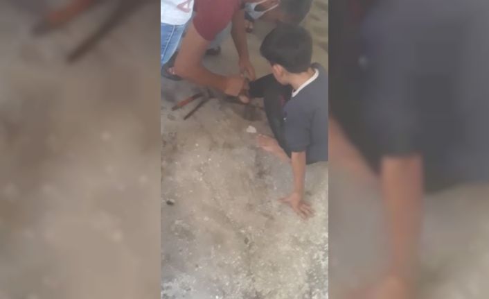Çocuğunu zincire bağlayan aileden 'pes' dedirten savunma 1