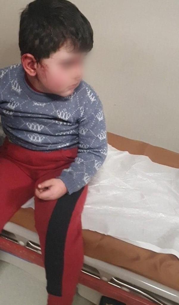 Ermenistan'ın sivil katliamı SuperHaber objektifinde 8