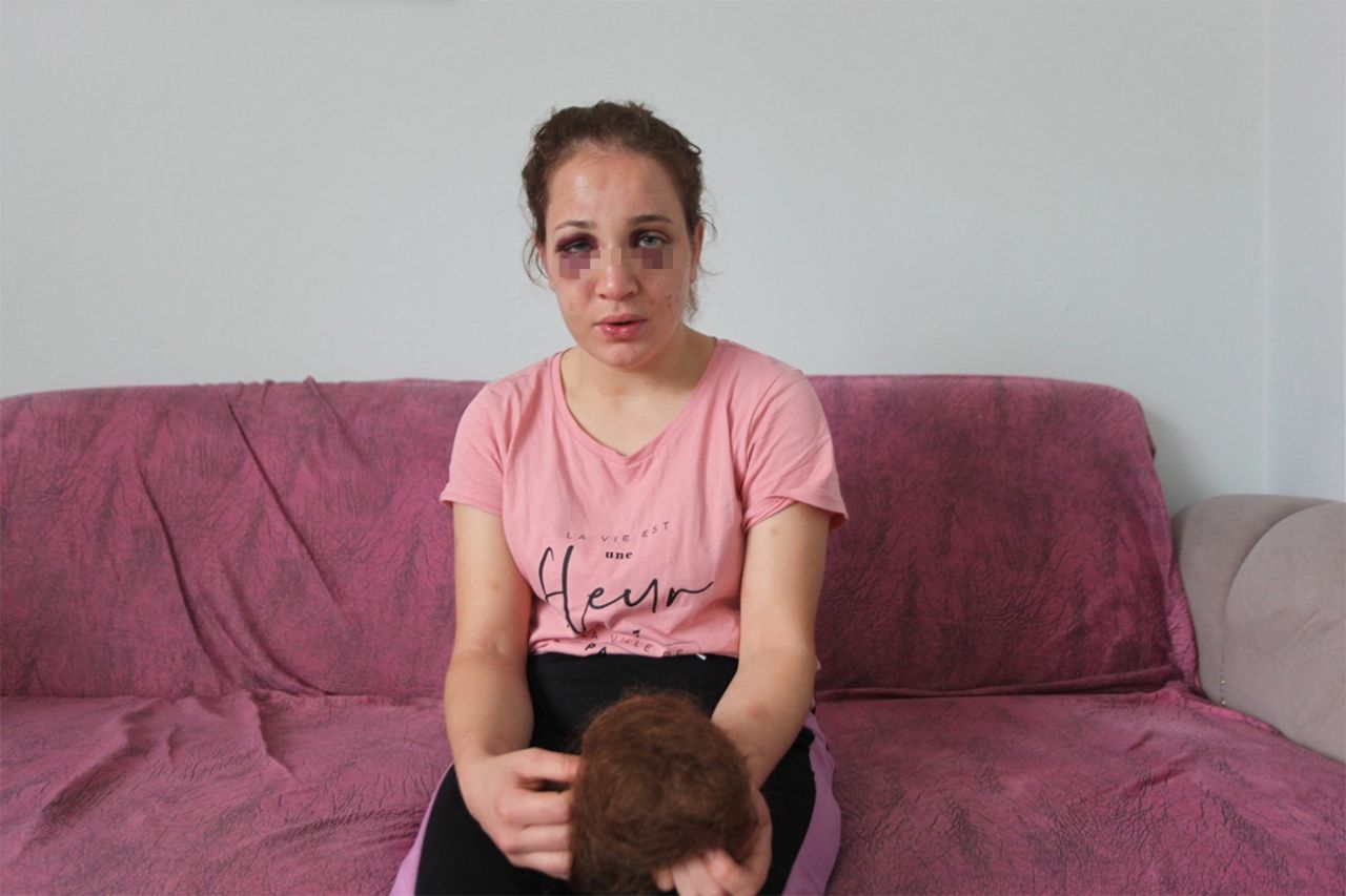 3 çocuk annesi Özlem'i kocası bu hale getirdi! 1