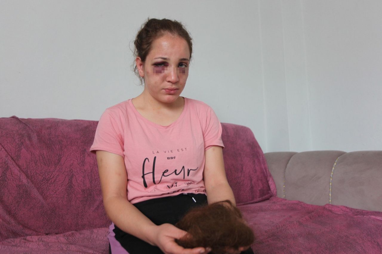 3 çocuk annesi Özlem'i kocası bu hale getirdi! 2
