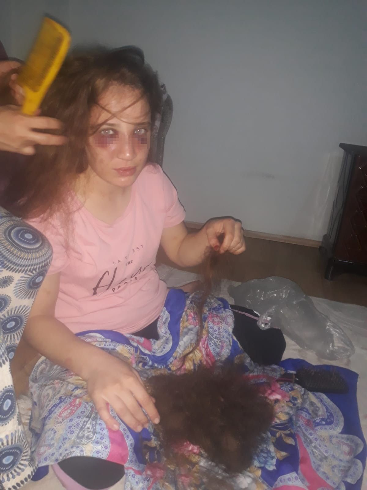 3 çocuk annesi Özlem'i kocası bu hale getirdi! 4