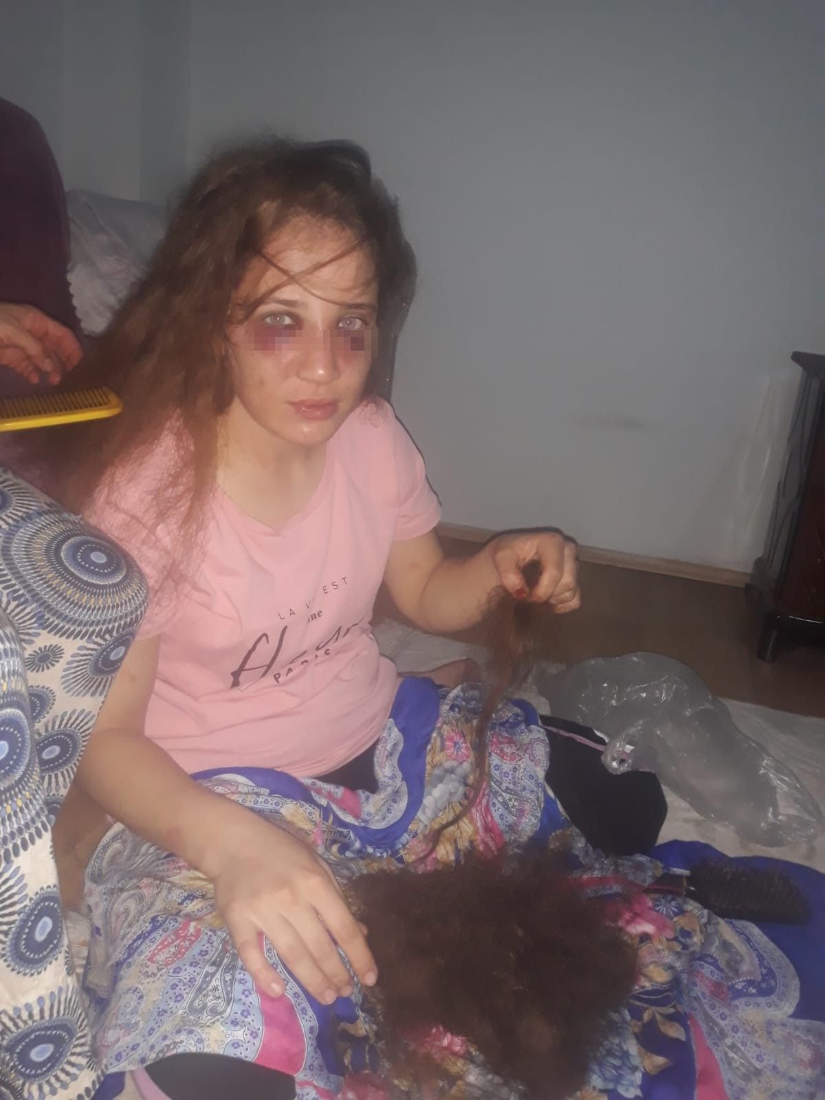 3 çocuk annesi Özlem'i kocası bu hale getirdi! 5