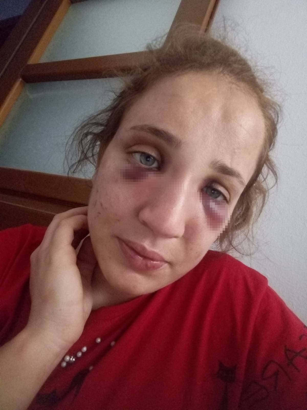 3 çocuk annesi Özlem'i kocası bu hale getirdi! 6