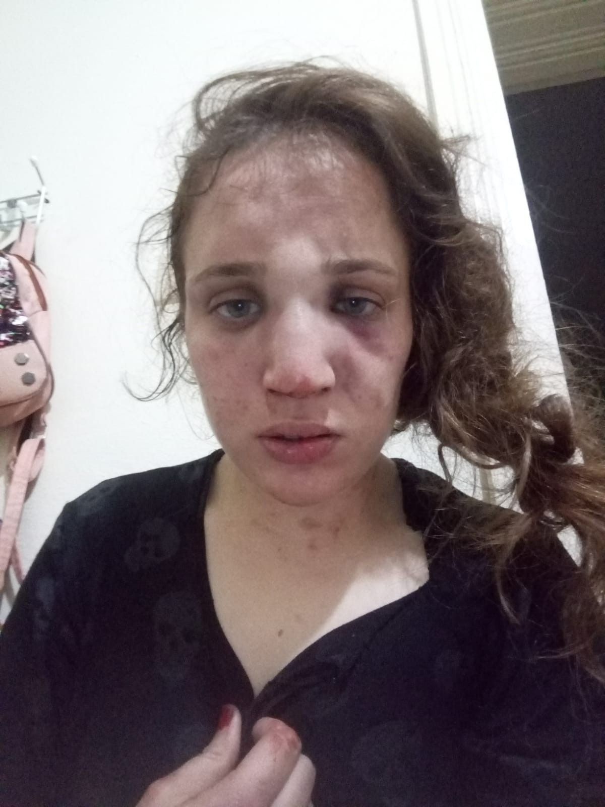 3 çocuk annesi Özlem'i kocası bu hale getirdi! 7