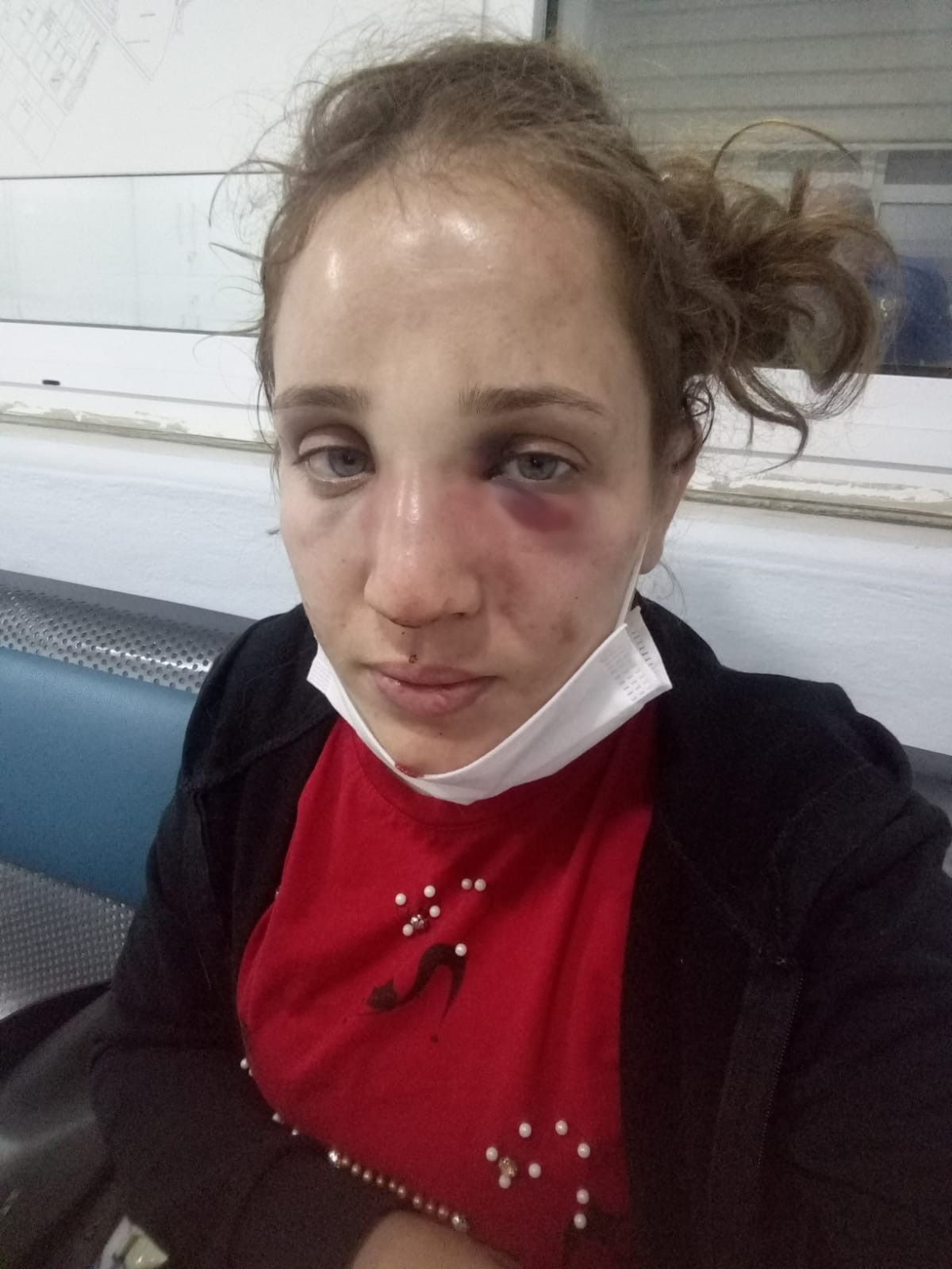 3 çocuk annesi Özlem'i kocası bu hale getirdi! 8