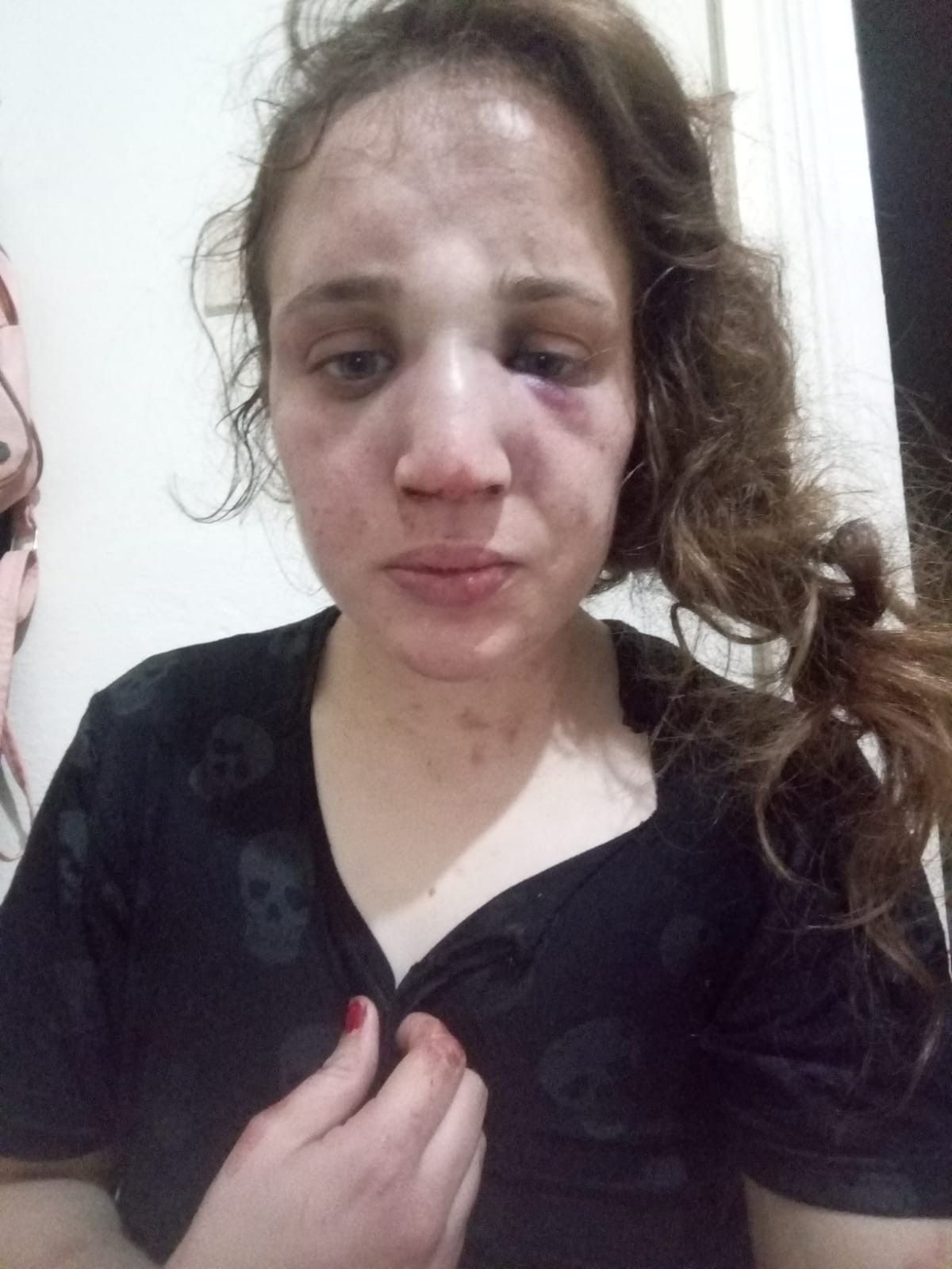 3 çocuk annesi Özlem'i kocası bu hale getirdi! 9