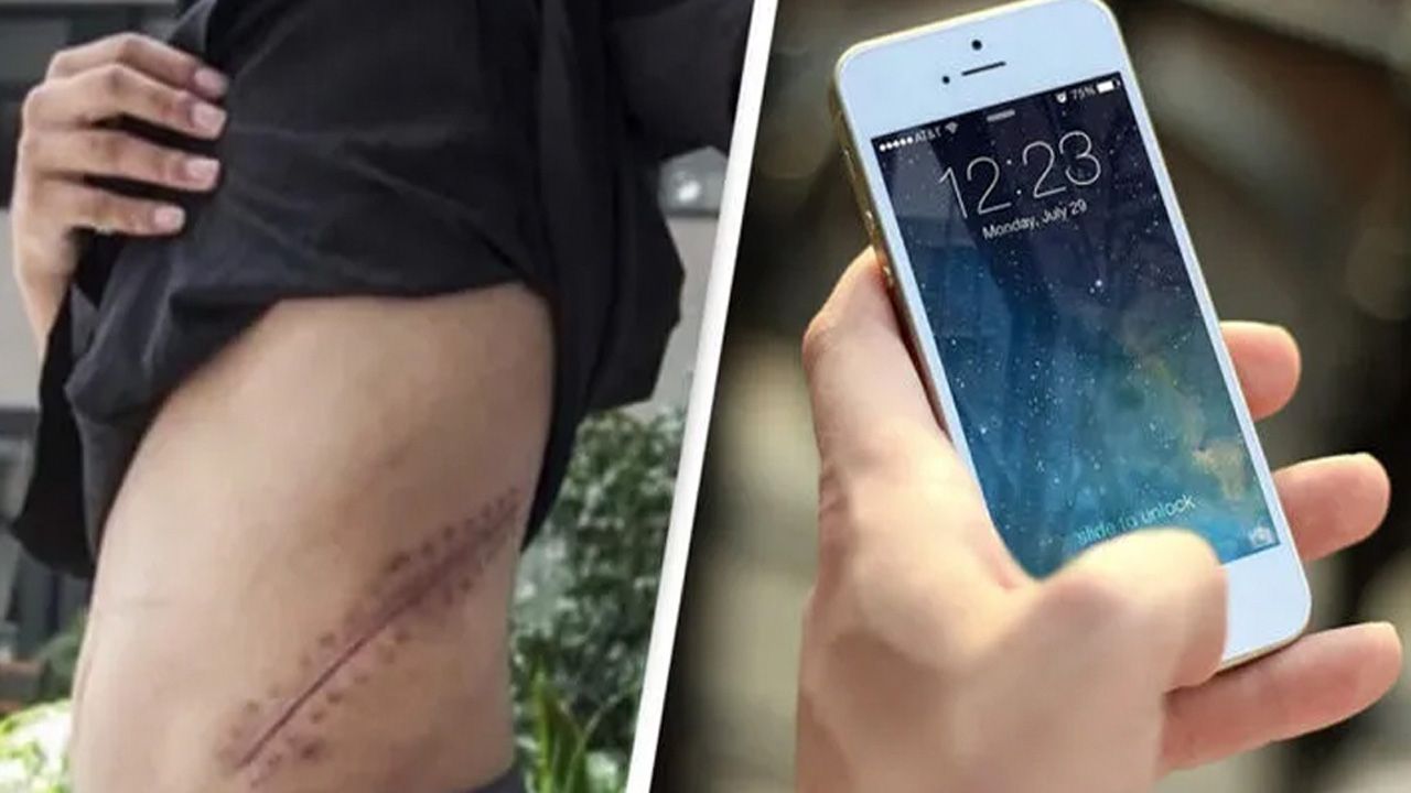 iPhone için böbreğini satan genç yatalak kaldı! 1