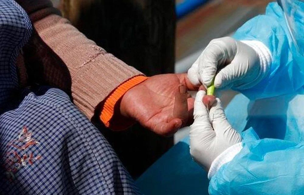 Bolivya'da insanlar arasında yayılmaya başladı! 'Chapare' virüsü 3 kişiyi öldürdü... 10