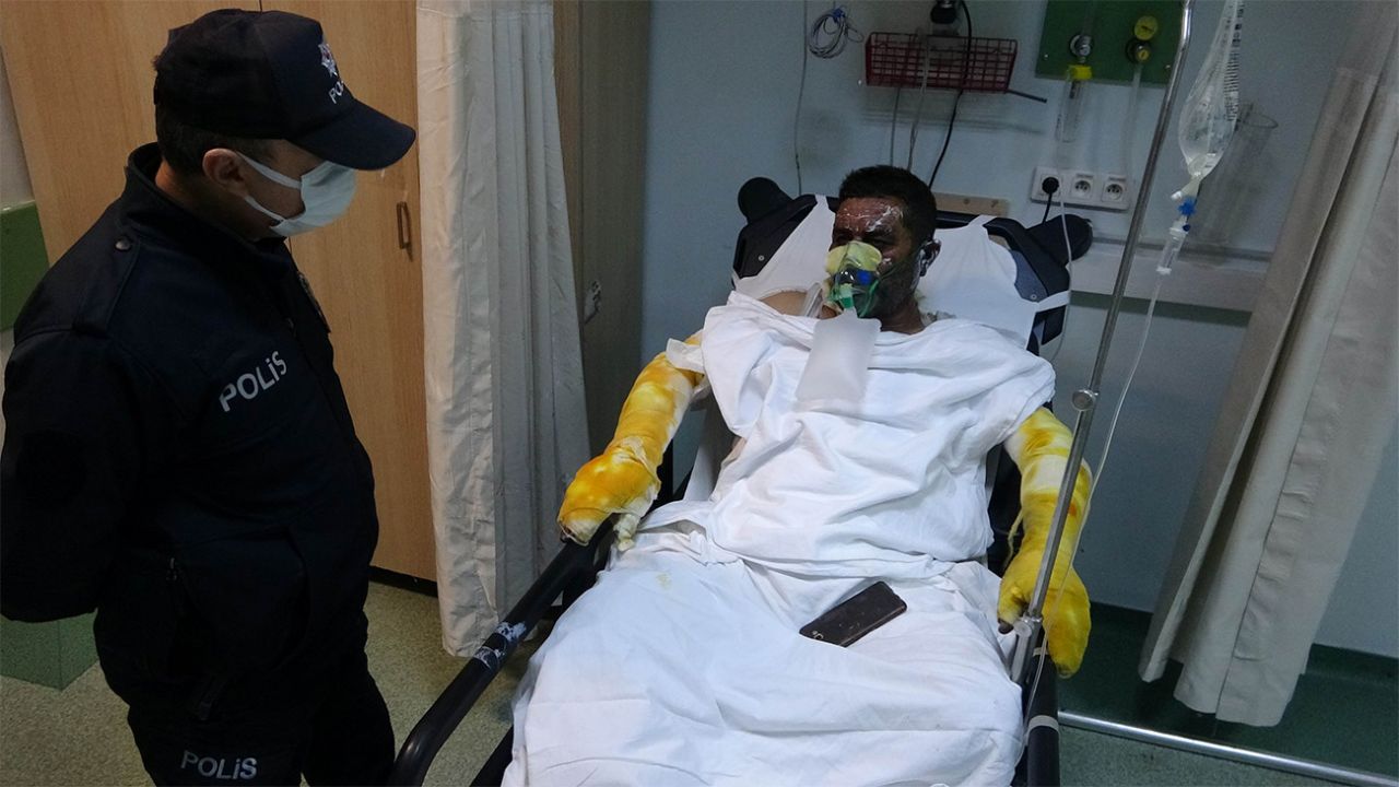 Yangında ailesini yanmaktan kurtardı... Kendisi yanarak hastanelik oldu! 1