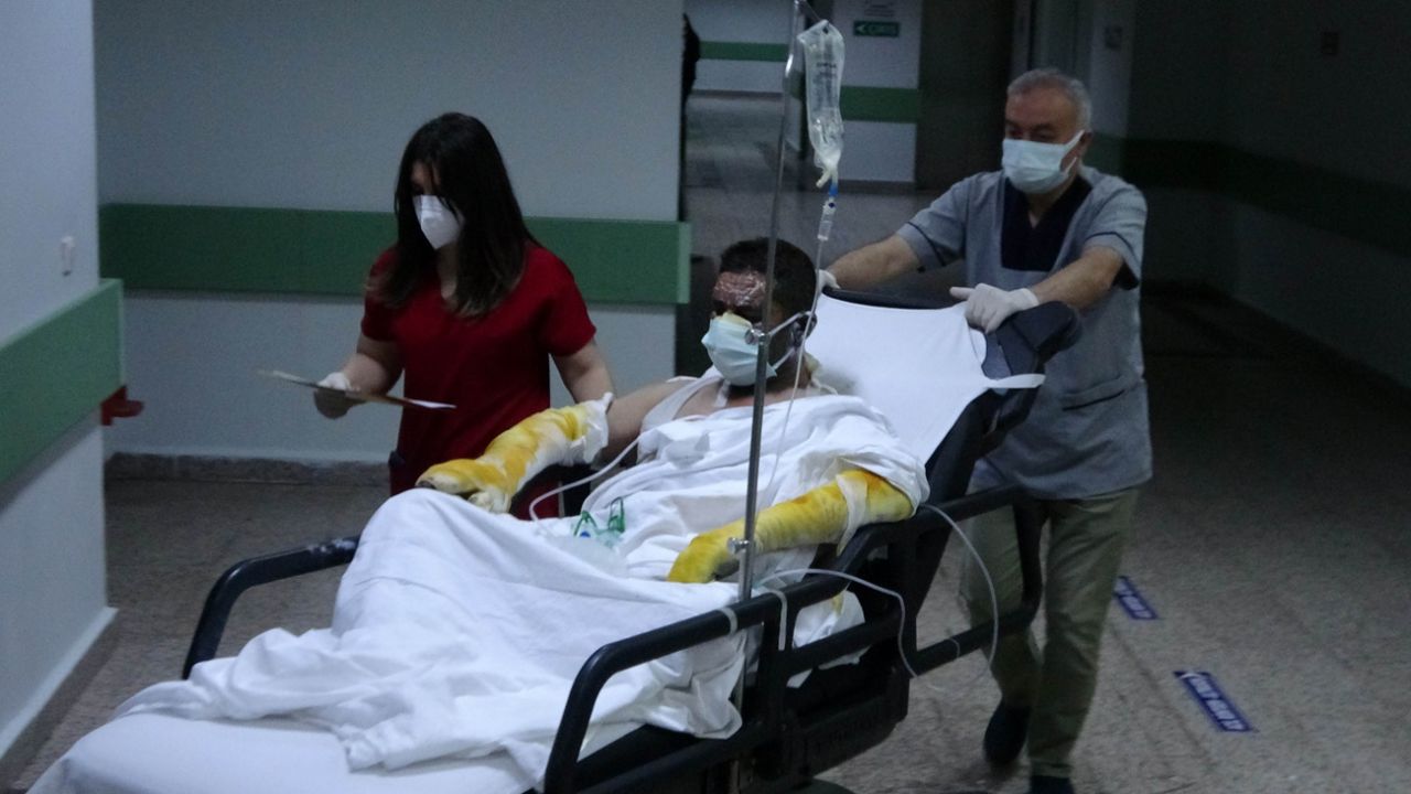 Yangında ailesini yanmaktan kurtardı... Kendisi yanarak hastanelik oldu! 5