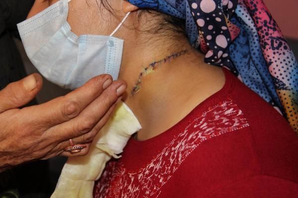 Boşanmak istediği eşi, çocuklarının önünde boğazını kesti! 3