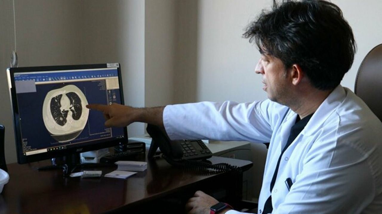 Doç. Dr. Taşçı: Kovid-19 akciğerdeki solunum keseciklerinde hasara yol açıyor 1