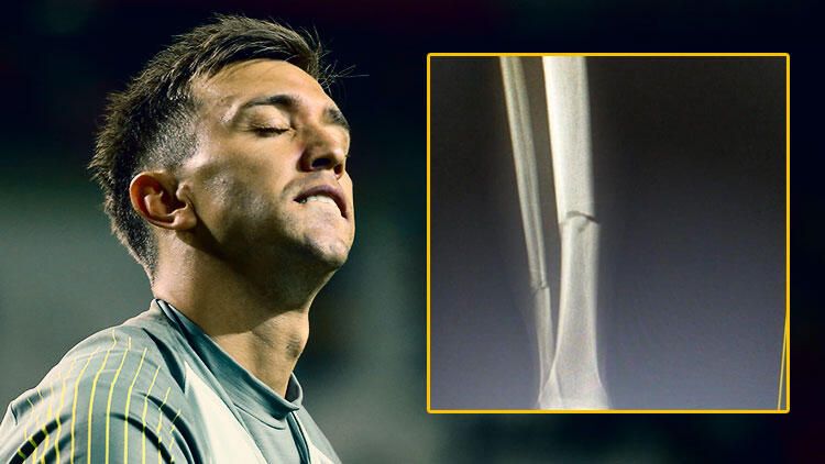 Fernando Muslera geri dönüyor 6